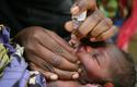 Polio UNICEF - ©UNICEF Polio UNICEF - ©UNICEF