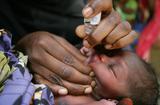 Polio UNICEF - ©UNICEF Polio UNICEF - ©UNICEF